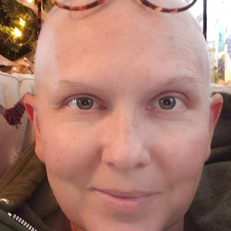 My Hair – Before, During, and After Chemotherapy